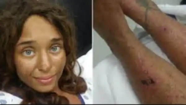 Woman Found Naked In Wilderness Recounts How She Survived For 3 Weeks Lost In The Woods